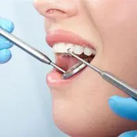Οδοντίατροι: Πώς θα δέχονται τον κόσμο -Σε ποιες περιπτώσεις χρειάζεται rapid test